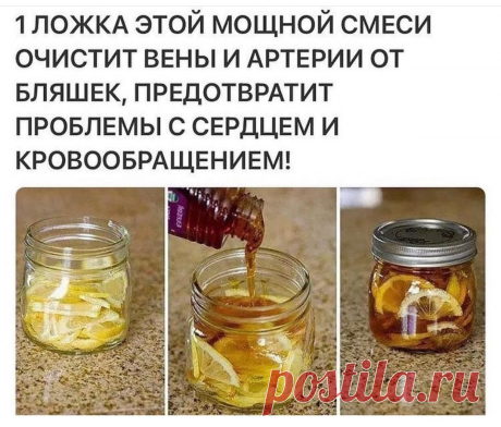 В любой момент бляшка может оторваться и произойдёт внезапная смерть. – Telegraph