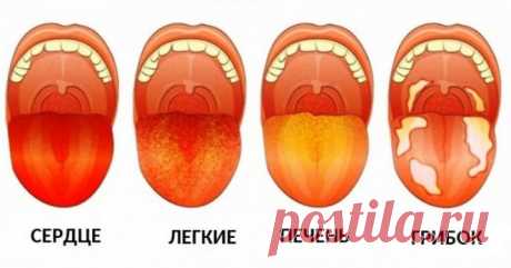 3 вещи, которые ваш язык пытается рассказать о вашем здоровье
