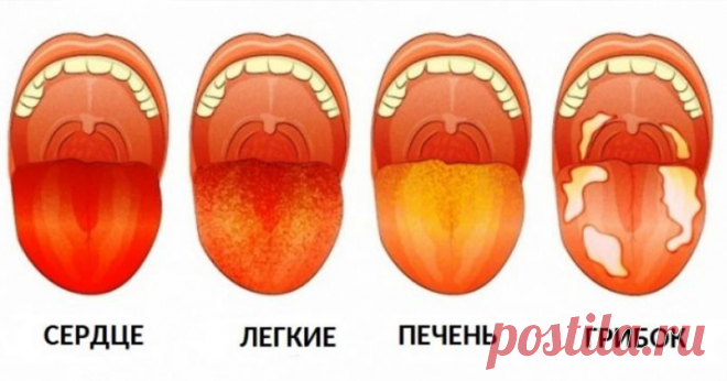 3 вещи, которые ваш язык пытается рассказать о вашем здоровье - Образованная Сова Диагностика языка происходит из древней медицинской практики Аюрведы, системы, которая поддерживает общее здоровье посредством тщательного наблюдения за телом и умом. Его предпосылка заключается в том, что мы составлены из различных пропорций природных элементов – воздуха, земли, огня, воды и эфира, которые составляют 3 основных конституционных типа: Доши вата (воздух и эфир), Капха (земля и вода) …