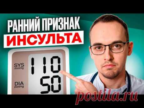 ТОП-3 ОПАСНЫХ ПРЕДВЕСТНИКА ИНСУЛЬТА. Как спасти сосуды головного мозга?