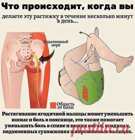 Растягивание ягодичной мышцы уменьшит боль в пояснице