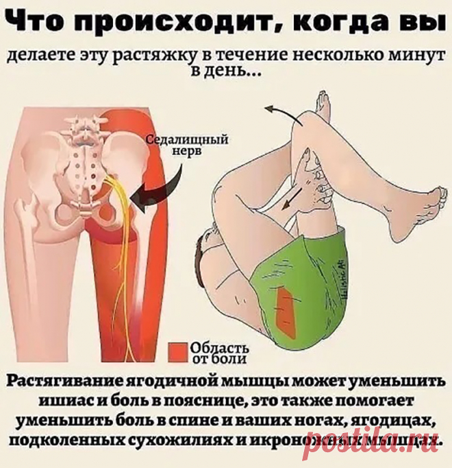 Растягивание ягодичной мышцы уменьшит боль в пояснице
