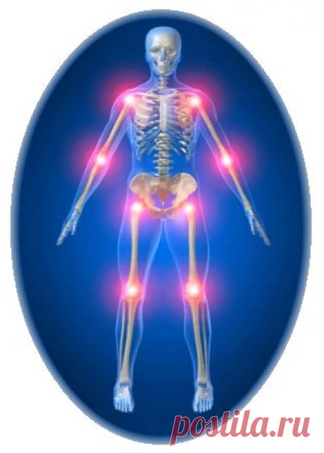Лечение артроза народными методами | Друг пенсионера