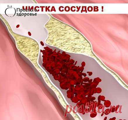 ЧИСТКА СОСУДОВ
У моей мамы после 50 лет стали иногда неметь пальцы рук и ног. Приятельница, медсестра подсказала, что это связано с сосудами. И научила, как за ними следить.
Курс лечения такой:
Вечером нужно взять 1/3 стакана семян льна, залить 1 л воды, довести до кипения и 2 часа выдержать на водяной бане. За ночь отвар должен настояться, а утром его следует процедить. Должно получиться примерно примерно 850 мл киселеподобной жидкости. Ее нужно выпить за 5 дней: по 1/3 стакана утром натощак и