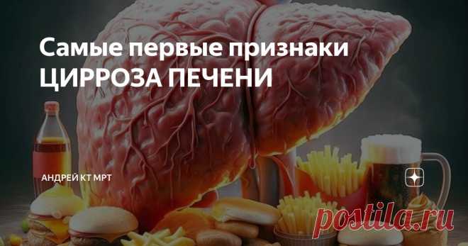 Самые первые признаки ЦИРРОЗА ПЕЧЕНИ Статья автора «Андрей КТ МРТ» в Дзене ✍: В этой статье я хочу акцентировать внимание не на том, как обнаружить цирроз. Запущенный цирроз хорошо видно на УЗИ, КТ и МРТ.