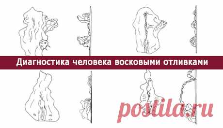 Диагностика человека восковыми отливками