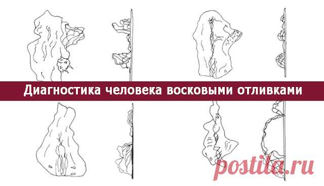 Диагностика человека восковыми отливками