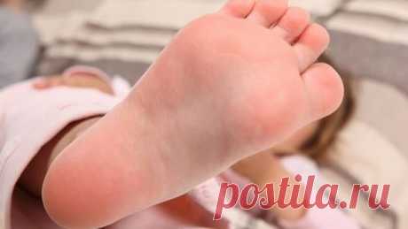 ШПОРУ ВЫЛЕЧИЛА ЗА 3 ДНЯ Поделюсь рецептами от пяточных шпор. Прошлым летом на юге после ванн у меня так разболелась нога, что я не знала, куда ее деть. Пятка горела огнем. Приехав домой, побежала к хирургу. Молодая врач сделала снимок и объявила, что у меня после ванн обострилась пяточная шпора. Дала мне какую-то «памятку» - и все. Я поняла, что надо самой лечиться. Обратилась к народной медицине - стала искать рецепты от шпор. Все, что нашла, выписала и посылаю вам. Ведь ...