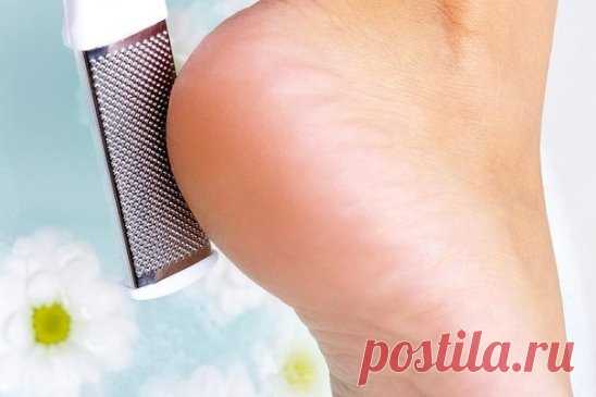 Как сделать пятки гладкими и ухоженными? 
Нужно только купить в аптеке тюбик мази календулы (20 г) и ампулку жидкого витамина А (10 мл), так будет легче дозировать, поскольку соотношение должно быть 1:2. В небольшой емкости хорошенько перемешайте витамин А и мазь. Вот собственно и все. Затем переложите готовый крем в чистую баночку и храните в холодильнике. Часто пятки оказываются в запущенном состоянии, устройте им витаминный штурм. На протяжении недели по вечерам мойте н...