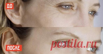 4 эффективных способа избавления от «бульдожьих» щечек