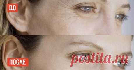 4 эффективных способа избавления от «бульдожьих» щечек