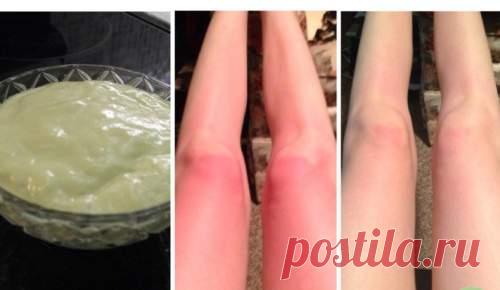 Нанесите эту трехкомпонентную смесь из кокосового масла на солнечный ожог и смотрите, как быстро он заживает Удивительный результат! Летнее время — это отдых, плавание и отдых на пляже, игра в песочный волейбол и наслаждение прекрасной погодой. К сожалению, все,