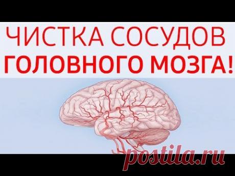Как очистить сосуды головного мозга. Бляшки в сосудах головного мозга! Нужно каждый день употреб...