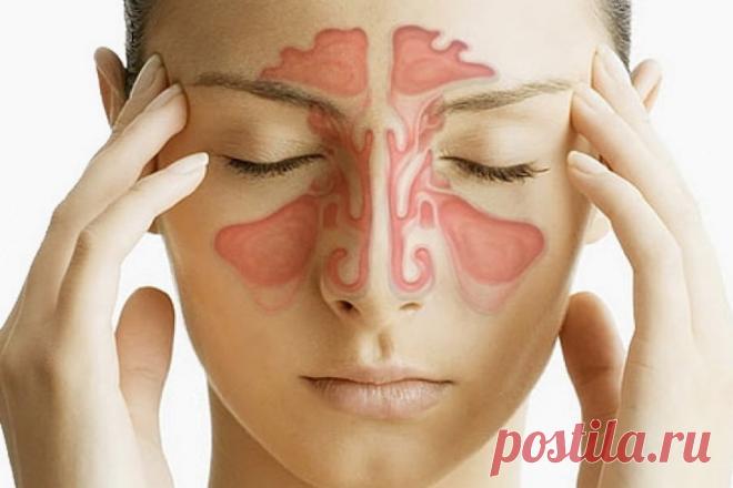 5 признаков синусовой инфекции (и как от нее избавиться) Любой, у кого была синусовая инфекция, знает, насколько болезненной и раздражающей она может быть. 
Синусит возникает, когда ткань в синусовом проходе воспаляется, опухает или и то и другое. Это проис…