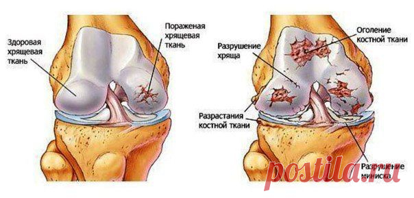 Упрощая жизнь
