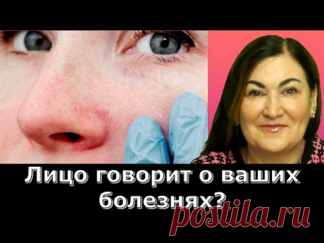 КАК ПОНЯТЬ ЧЕМ ВЫ БОЛЕЕТЕ ПО ВАШЕМУ ЛИЦУ? - YouTube