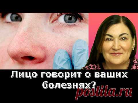 КАК ПОНЯТЬ ЧЕМ ВЫ БОЛЕЕТЕ ПО ВАШЕМУ ЛИЦУ? - YouTube