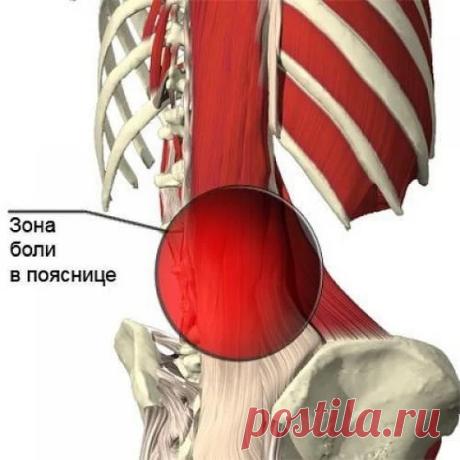 (+1) СПЕЦИАЛЬНЫЕ УПРАЖНЕНИЯ ПРИ БОЛЯХ В ПОЯСНИЦЕ