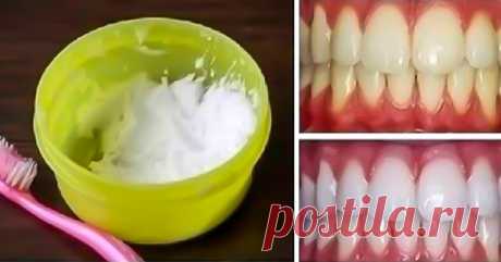 Зубной камень и желтизна зубов: мощное средство для быстрого устранения!