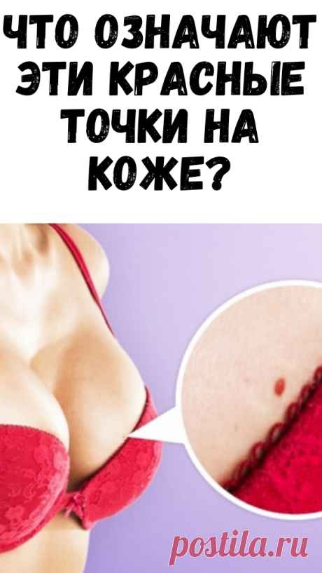 О чем говорят эти красные точки на коже?