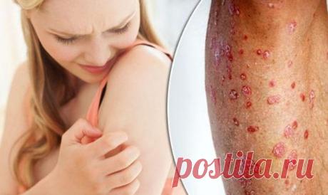 Мерзімсіз тұрмыстық техниканы тез арада қалай жасыру керек? Тәжірибе: Сіздің денсаулығыңызға, достарыңызға қамқорлық. Призофилия - бұл ағзаға және басқа шағып жатқан тамақпен бірге созылмалы жаңылыс. Әр түрлі очки және омега бар; Мұндай жағдайда біз тезірек және ұзақ уақытқа созылатын уәделерді аламыз.