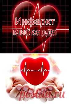 Поиск на Постиле: Инфаркт