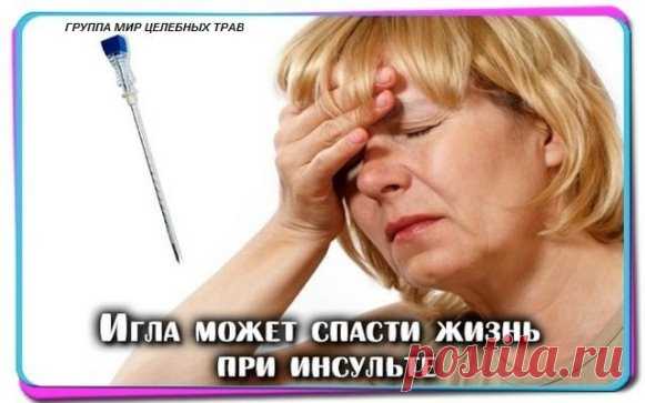 Это совет от китайского профессора.
Держите в доме шприц или иглу. Это удивительный и нетрадиционный способ спасения от инсульта. Вы никогда заранее не знаете, что чья-то жизнь может зависеть от вас.
