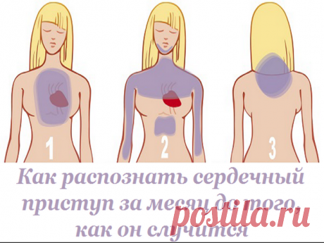 (52) Одноклассники