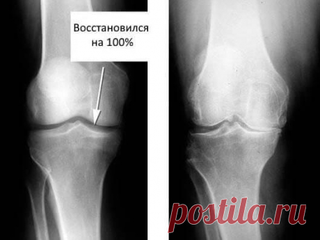 Купить IMOSTEON недорого. Цены, отзывы. Закажите IMOSTEON сейчас!