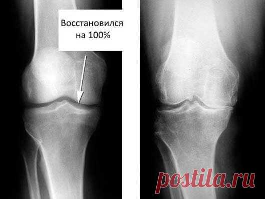 Купить IMOSTEON недорого. Цены, отзывы. Закажите IMOSTEON сейчас!