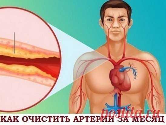 Как очистить артерии за месяц: напиток, который обеспечит сердцу надежную защиту.
Слишком жирная пища, особенно животного происхождения, приводит к повышению уровня холестерина в крови. Избыточный холестерин может откладываться на внутренних стенках сосудов и артерий, уменьшая проходимость крови…