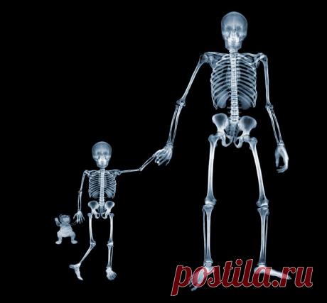 О вреде рентгена для детей и не только...