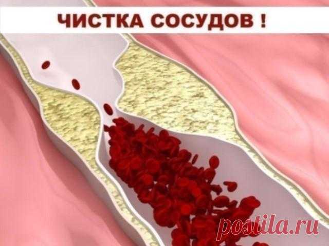 ЧИСТКА СОСУДОВ!