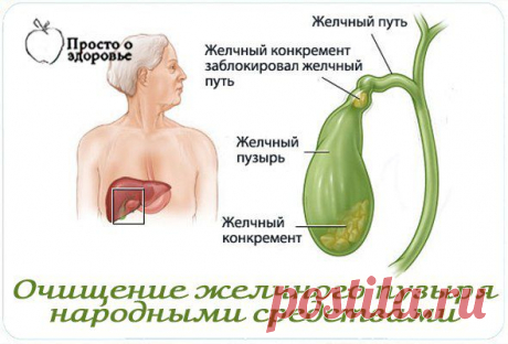 Очищение желчного пузыря народными средствами.