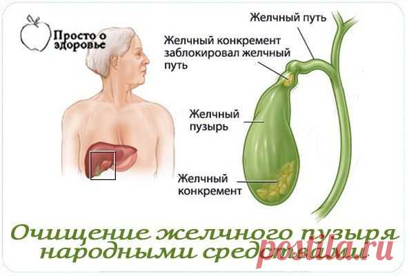 Очищение желчного пузыря народными средствами.