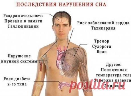 8 последствий плохого сна / Будьте здоровы
