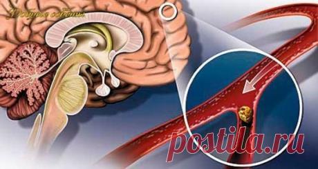 Народные средства для улучшения мозгового кровообращения
Нарушение мозгового кровообращения 
Гипертония и атеросклероз — две основные причины, приводящие к нарушению мозгового кровообращения.
Именно из-за них развивается паралич, падает зрение, теряется координация, нарушается движение, возникает инсульт.
Хронические сосудистые заболевания мозга называются дисциркуляторной энцефалопатией. 
Читать далее на сайте: 
https://my-pomoshnik.ru/narodnye-sredstva-dlya-uluchsheniya-mozgovogo-krovoobrashhen