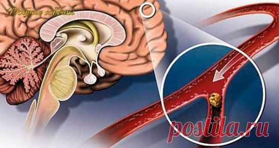 Народные средства для улучшения мозгового кровообращения
Нарушение мозгового кровообращения 
Гипертония и атеросклероз — две основные причины, приводящие к нарушению мозгового кровообращения.
Именно из-за них развивается паралич, падает зрение, теряется координация, нарушается движение, возникает инсульт.
Хронические сосудистые заболевания мозга называются дисциркуляторной энцефалопатией. 
Читать далее на сайте: 
http://my-pomoshnik.ru/narodnye-sredstva-dlya-uluchsheniya-mozgovogo-krovoobrashhen
