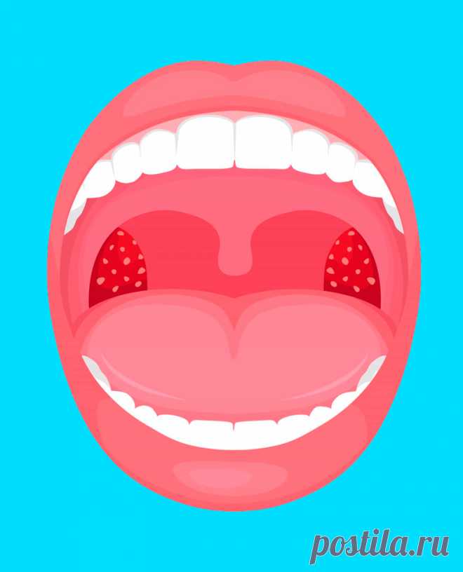 15 рецептов народной медицины. Как лечить ангину? От АНГИНЫ и БОЛИ в горле помогут проверенные годами рецепты народной медицины. Как принимать хрен, лимон, лук и чеснок при ангине – читайте в нашей статье.