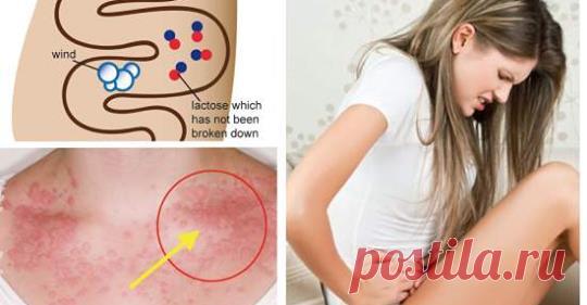 5 симптомов непереносимы лактозы и что с этим делать