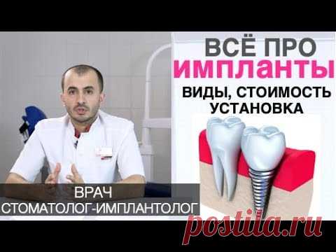 Зубные импланты - как выбирать, цена, установка имплантов зубов, гарантия. Имплантация зубов.