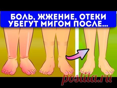 Невероятно, ноги как пушинки!15 домашних способов от отеков ног