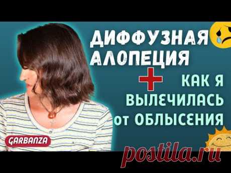 Диффузная алопеция. Лечение выпадения волос