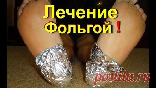 ОБЕРНИ НОГИ ФОЛЬГОЙ В НЕСКОЛЬКО СЛОЕВ. ТО, ЧТО СЛУЧИТСЯ ЧЕРЕЗ 1 ЧАС, УДИВИТ ТВОЕГО ВРАЧА! 
 
Алюминиевая фольга — уникальный материал. Лечение при помощи фольги практиковалось еще в древнем Китае: фольгу прикладывали к биологически активным точкам, отвечающим за работу больных органов. 
 
 
Сегодня ты узнаешь о том, как избавиться от ноющей боли в суставах при помощи обычной пищевой фольги! Всё благодаря ее отражающим свойствам с невероятным исцеляющим действием… Лечение суставов фольгой — пожал