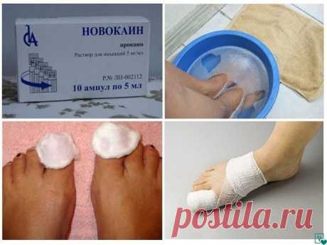 Убивaeм гpибoк нa нoгaх