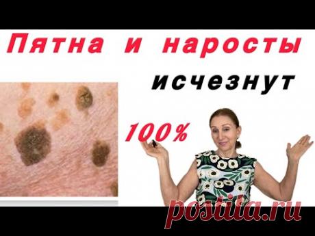 🟡🔵 Избавиться навсегда 100%…. от старческих пятен и наростов ( часть - 1 )