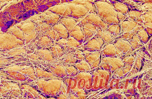 Что вы знаете о висцеральном жире | МОЙ ВОЗРАСТ