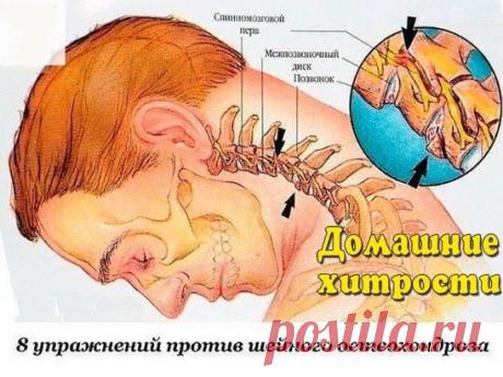 8 упражнений против шейного остеохондроза