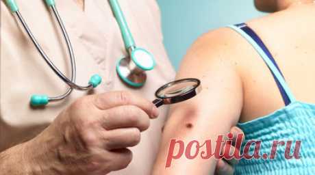 Дерматолог Егорова посоветовала не удалять родинки летом из-за риска развития рака. Врач-дерматолог, трихолог, косметолог Татьяна Егорова посоветовала не удалять родинки летом. По её словам, лучше это делать осенью или зимой. Читать далее