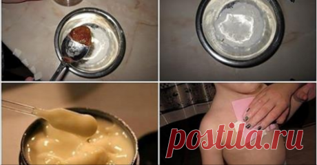 Компресс от сильного кашля. Вылечит за вечер!👍👍👍